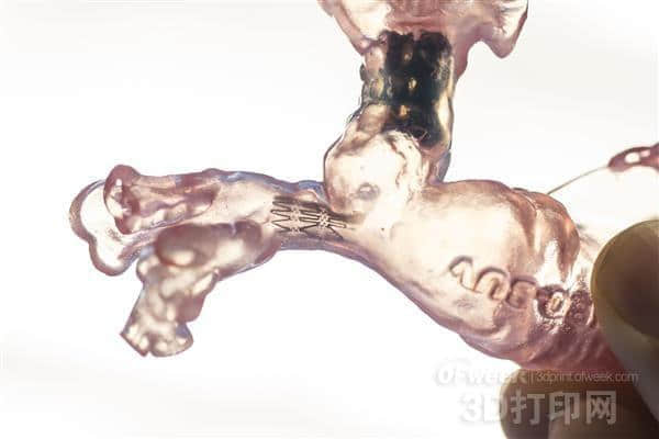 医生借3D打印心脏模型挽救婴儿的生命