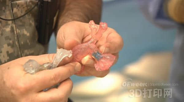 医生借3D打印心脏模型挽救婴儿的生命